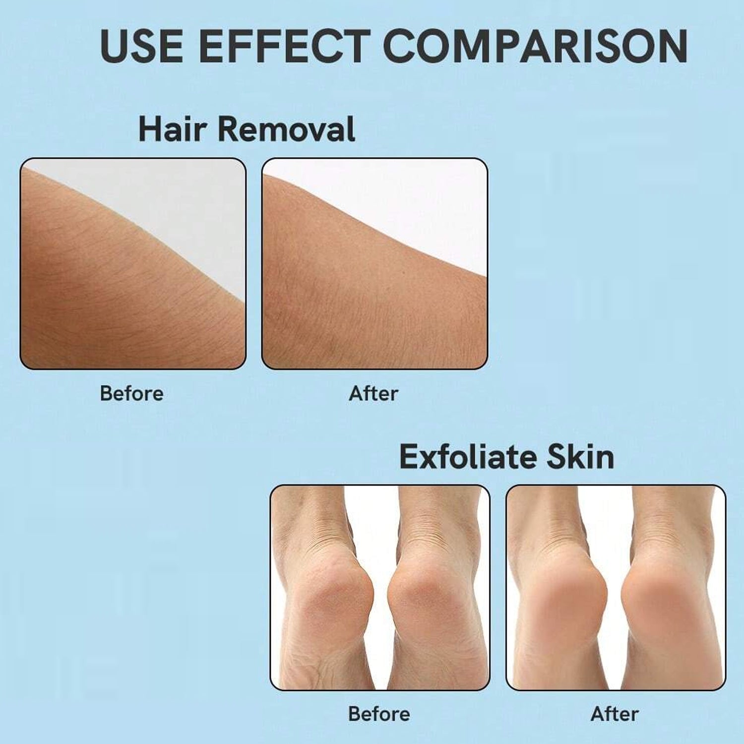Nano Hair Remover for Arms, Legs, Back One Sided Skin Hair Remover (1 Pc) Nano Hair Remover for Arms, Legs, Back One Sided Skin Hair Remover (1 Pc)